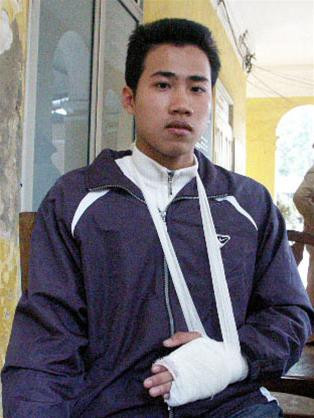 Hạ sĩ Huy phải bó bột tay trái