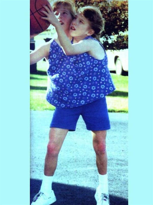 Hai chị em Abigail và Brittany Hensel Hai chị em Abigail và Brittany Hensel