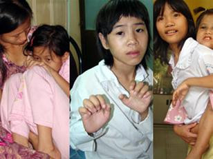 Từ trái sang: bé Trâm, bé Trang, bé Toan và bé Còi, bốn trong số những nạn nhân của nạn bạo hành trẻ em. Ảnh: Pháp luật TPHCM.