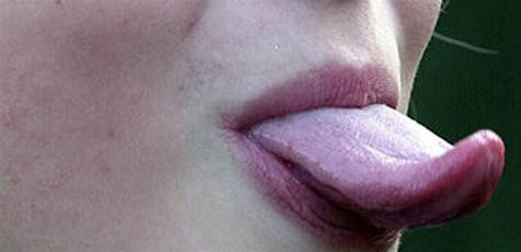 Hình minh họa (Krone)