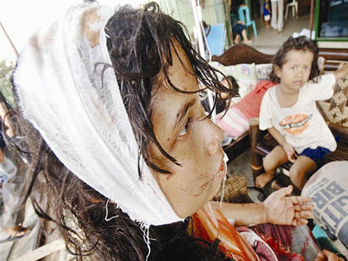 Những nạn nhân sống sót sau trận động đất ở Indonesia vẫn chưa hết kinh hoàng