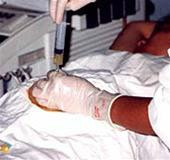 Chọc nước ối để thực hiện chẩn đoán dị tật ở thai nhi thông qua kết quả nhiễm sắc thể đồ