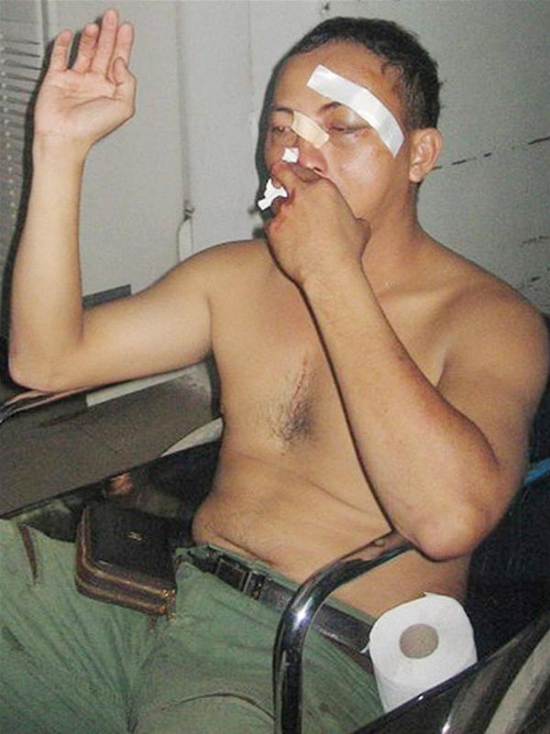 Anh Nguyễn Văn Minh Tiến tại BV Răng hàm mặt T.Ư