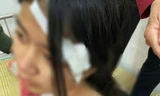 Hoàn cảnh éo le của bé gái 13 tuổi bị bà nội và hai người đàn ông tra khảo, đánh đập