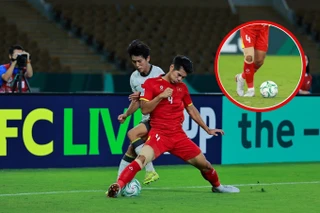 Miếng băng gối của Hiểu Minh ngay từ đầu trận là dấu hiệu không thể xem nhẹ