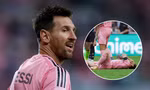 Cập nhật tình trạng chấn thương Messi trước World Cup 2026