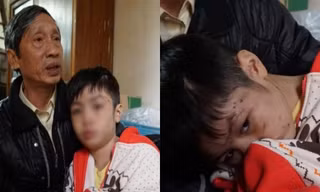 Bé trai 10 tuổi bị cha và mẹ kế đánh gãy tay: "2 năm rồi con mới được ăn bát phở"