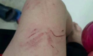 Bình Dương: Khỉ tấn công người dân, học sinh rồi lao lên cây chạy trốn