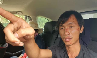 Vụ tai nạn thảm khốc ở Bình Thuận: Tài xế xe tải được đưa ra Nha Trang chụp chân