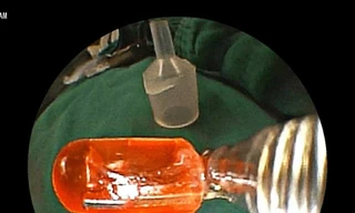 Trẻ nhỏ dễ hóc di vật do sự bất cẩn của phụ huynh