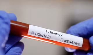 Việt Nam thêm 5 ca nhiễm COVID-19: Bé 2 tuổi cùng 4 người lây từ bệnh nhân số 34