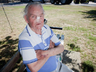 Đi khám răng, cụ ông mất mũi