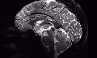 Hình ảnh rõ nét nhất về bộ não chúng ta từ siêu máy quét MRI