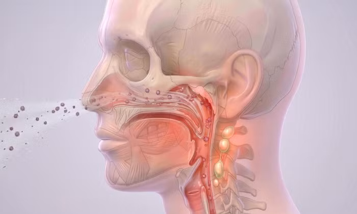 Bệnh não mô cầu nguy hiểm như thế nào và cách nhận biết sớm
