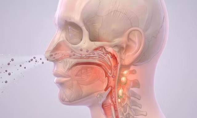 Bệnh não mô cầu nguy hiểm như thế nào và cách nhận biết sớm