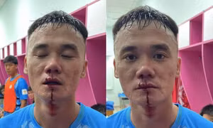 VFF phạt nặng hai cầu thủ đánh nhau ở giải hạng Nhất 