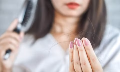 Điều gì khiến tình trạng rụng tóc gia tăng ở người trẻ?