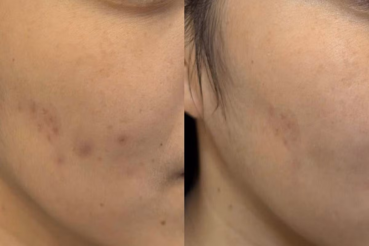 Elem Formulas và hướng đi mới cho doanh nghiệp skincare Việt ảnh 2