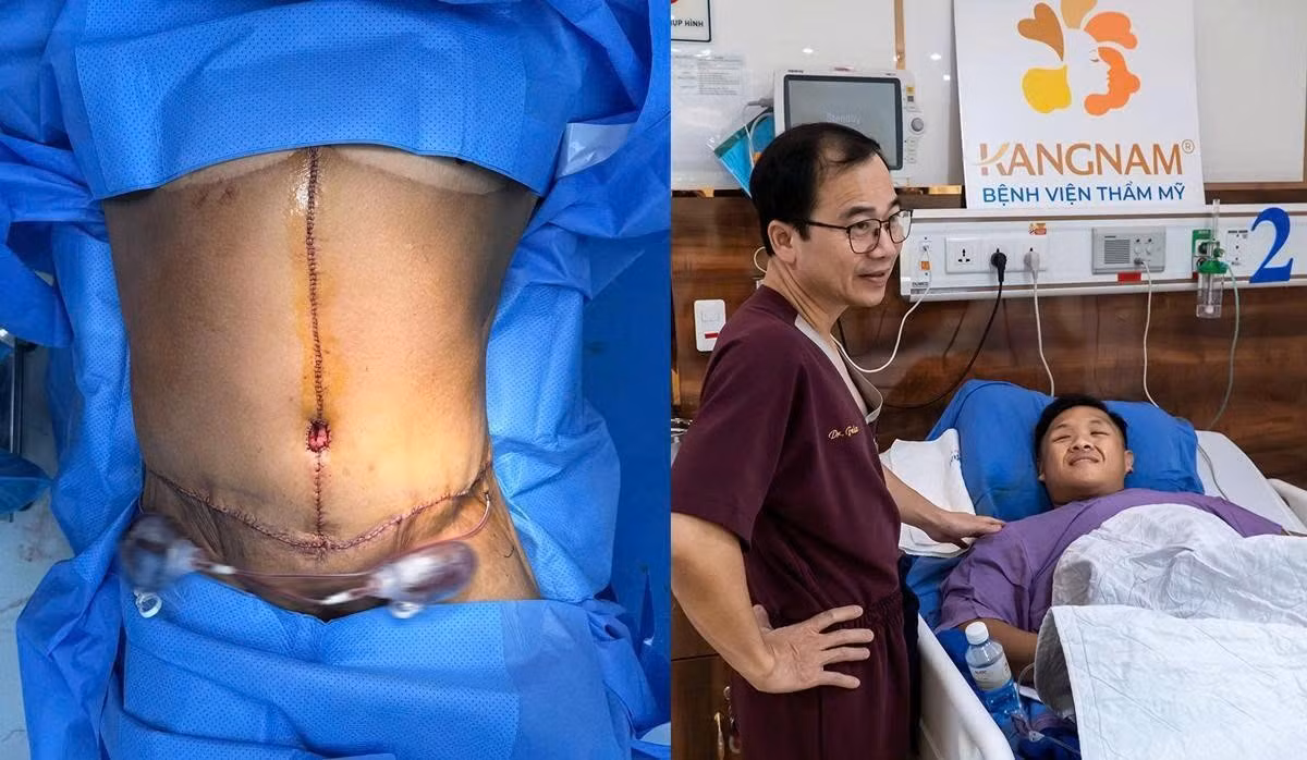 Ca phẫu thuật cắt da lần thứ 3 của Trọng Nhân kéo dài 10 tiếng với kết quả vượt mong đợi