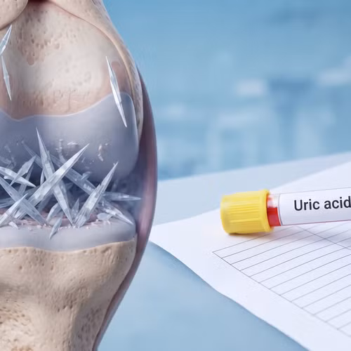 Axit uric cao tàn phá ngầm cơ thể thế nào dù không đau nhức?