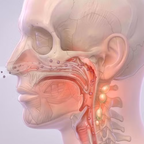 Bệnh não mô cầu nguy hiểm như thế nào và cách nhận biết sớm