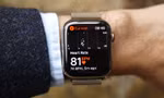 Apple Watch lập công giúp cứu người phụ nữ khỏi cục máu đông nguy hiểm