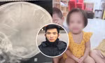 Vụ bé gái 3 tuổi ở Hà Nội bị đinh găm vào đầu: Nghi phạm lì lợm, quanh co chối tội