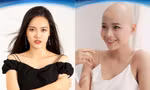 Những thí sinh ấn tượng của Miss World Vietnam 2022, có một cô gái vô cùng đặc biệt