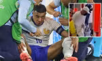 Mbappe gãy mũi, nguy cơ lỡ đại chiến với tuyển Hà Lan
