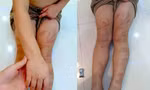 Thông tin mới vụ 6 trẻ mầm non ở Nghệ An bị đánh bầm tím người