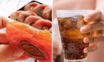 Cô bé 4 tuổi có sỏi trong dạ dày vì ăn quả hồng khô, bác sĩ nghĩ ra cách điều trị độc đáo