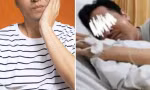 Một người ở Indonesia thiệt mạng chỉ vì sâu răng, các bác sĩ đưa ra cảnh báo