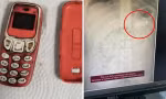 Một bệnh nhân vào viện vì đã nuốt cả chiếc điện thoại Nokia 3310, đến bác sĩ cũng choáng