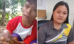 Chú heo con ở Philippines có khuôn mặt giống người, bác sĩ giải thích thế nào?