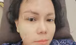 Việt Hương bị méo mặt