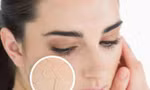 Mùa lạnh hanh khô nên ăn những thực phẩm này bởi giữ ẩm cực tốt