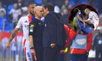 HLV Pháp bị cấm chỉ đạo tới 9 tháng vì làm hành động giống Zidane 