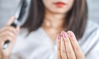 Điều gì khiến tình trạng rụng tóc gia tăng ở người trẻ?