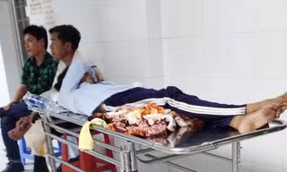 Chiều 21/10, anh Nghiệp tỉnh lại, nằm ngoài hành lang lầu 3 bệnh viện đa khoa Cà Mau