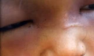 Chấn động vụ bé 3 tuổi bị hành hạ như thời trung cổ