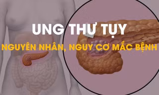 Ung thư tụy: Vì sao lại mắc bệnh?
