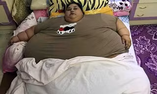 Iman Ahmad Abdulati hiện nặng tới 500kg.