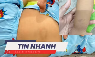 TIN NHANH: Đình chỉ cơ sở giữ trẻ sau vụ bé gái hơn 2 tuổi bị chấn thương 'vùng kín'