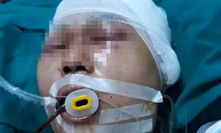 Nam sinh bị đánh chấn thương sọ não.