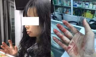Hình ảnh chị Diệu L. sau khi bị đánh.