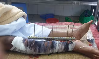 Nhóm côn đồ chém gục 3 ngư dân trên biển Hải Phòng