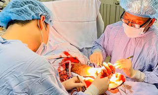 Ca mổ nối bàn tay cho anh N.Đ.P 