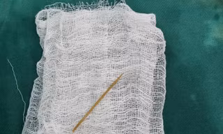 Ngậm tăm dài 5cm nằm xem ti vi rồi ngủ quên, nuốt luôn vào dạ dày