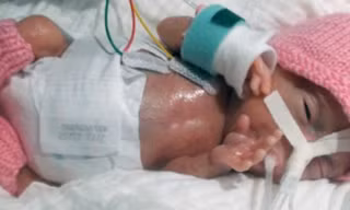 Emilia lúc mới sinh. Ảnh: CEN.