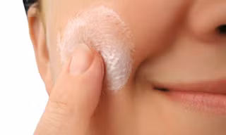 Mụn trứng cá bọc khiến người bệnh mất tự tin